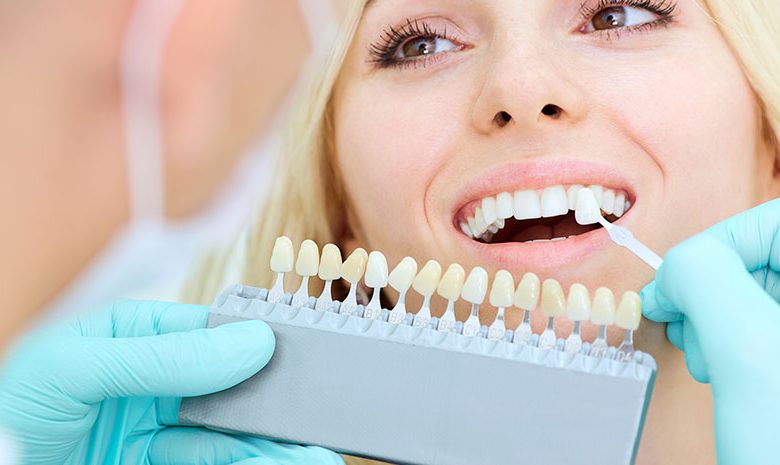 Photo of The Secrets of Cosmetic Dentistry